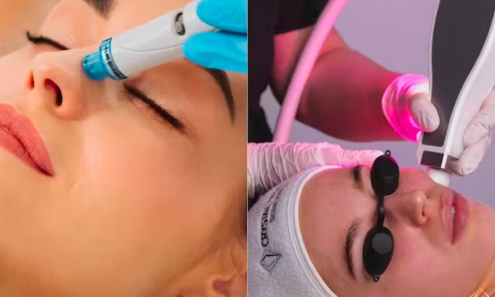 Which is better Hydradermabrasion vs Crystal Microdermabrasion Exfoliation?