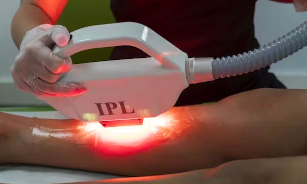All you need to know about IPL Hair Removal